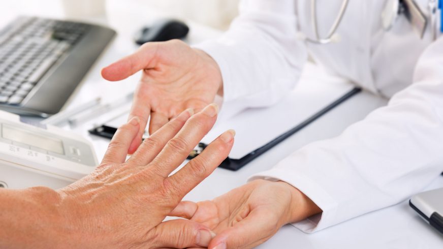 Rheumatoid arthritis tends to affect the joints that attach your fingers to your hands and your toes to your feet.